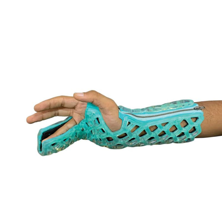 FlexiOH® Ulnar Gutter Immobilizer S