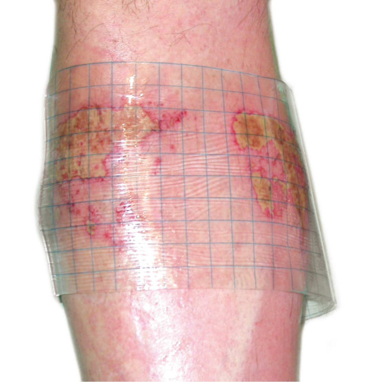 HydroTac transparent Gel Dressing 5 cm x 7.5 cm