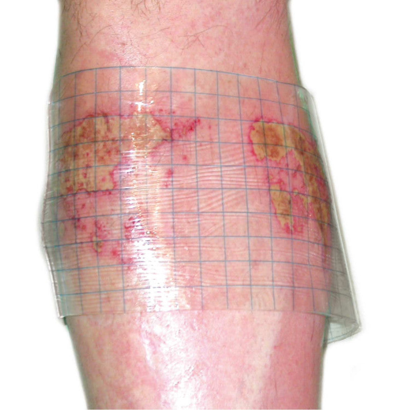HydroTac transparent Gel Dressing 5 cm x 7.5 cm
