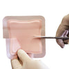 ALLEVYN™ Foam Dressing Adhesive 7 x 8 cm